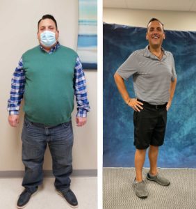 Weight-Loss Surgery